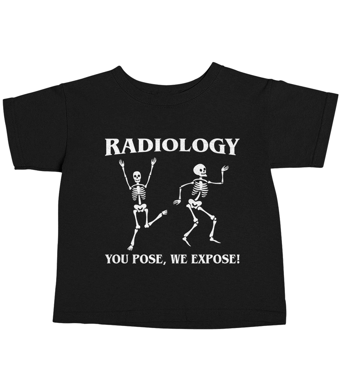 Radiology you pose we expose Black baby toddler Tshirt 2 years