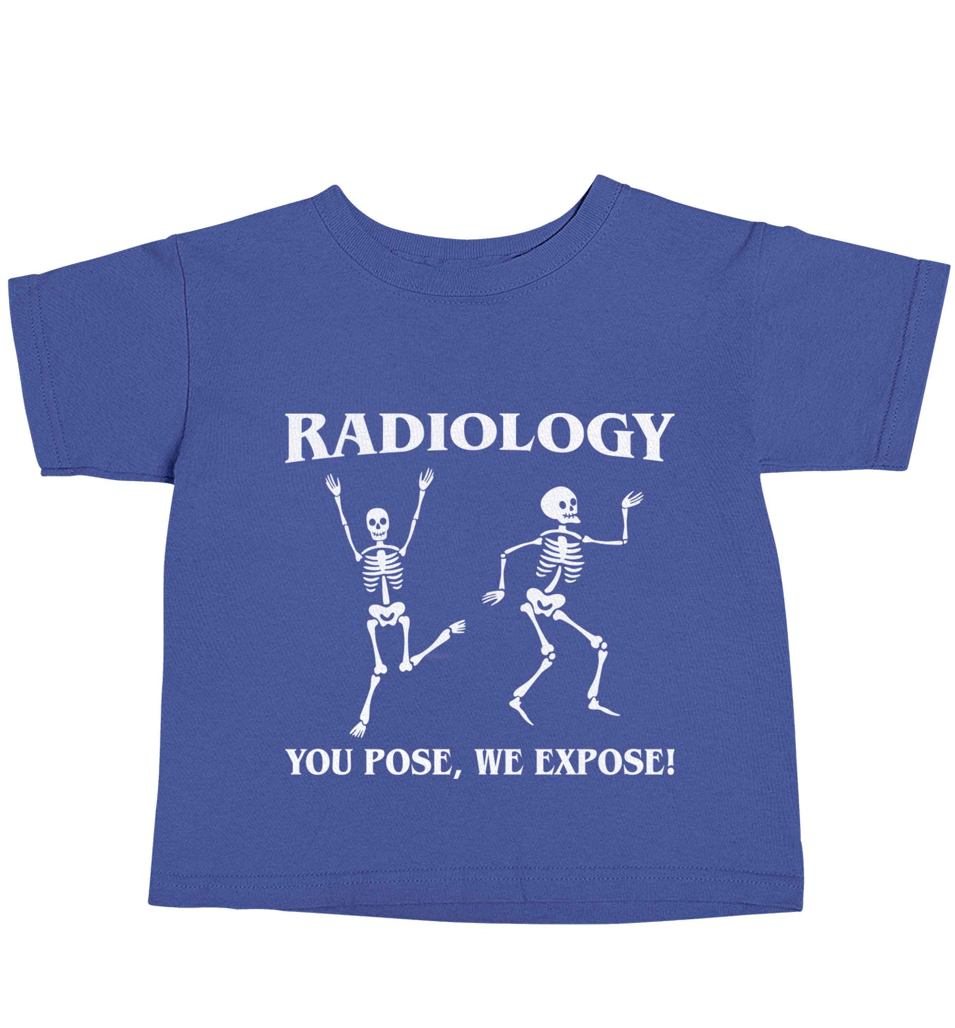 Radiology you pose we expose blue baby toddler Tshirt 2 Years
