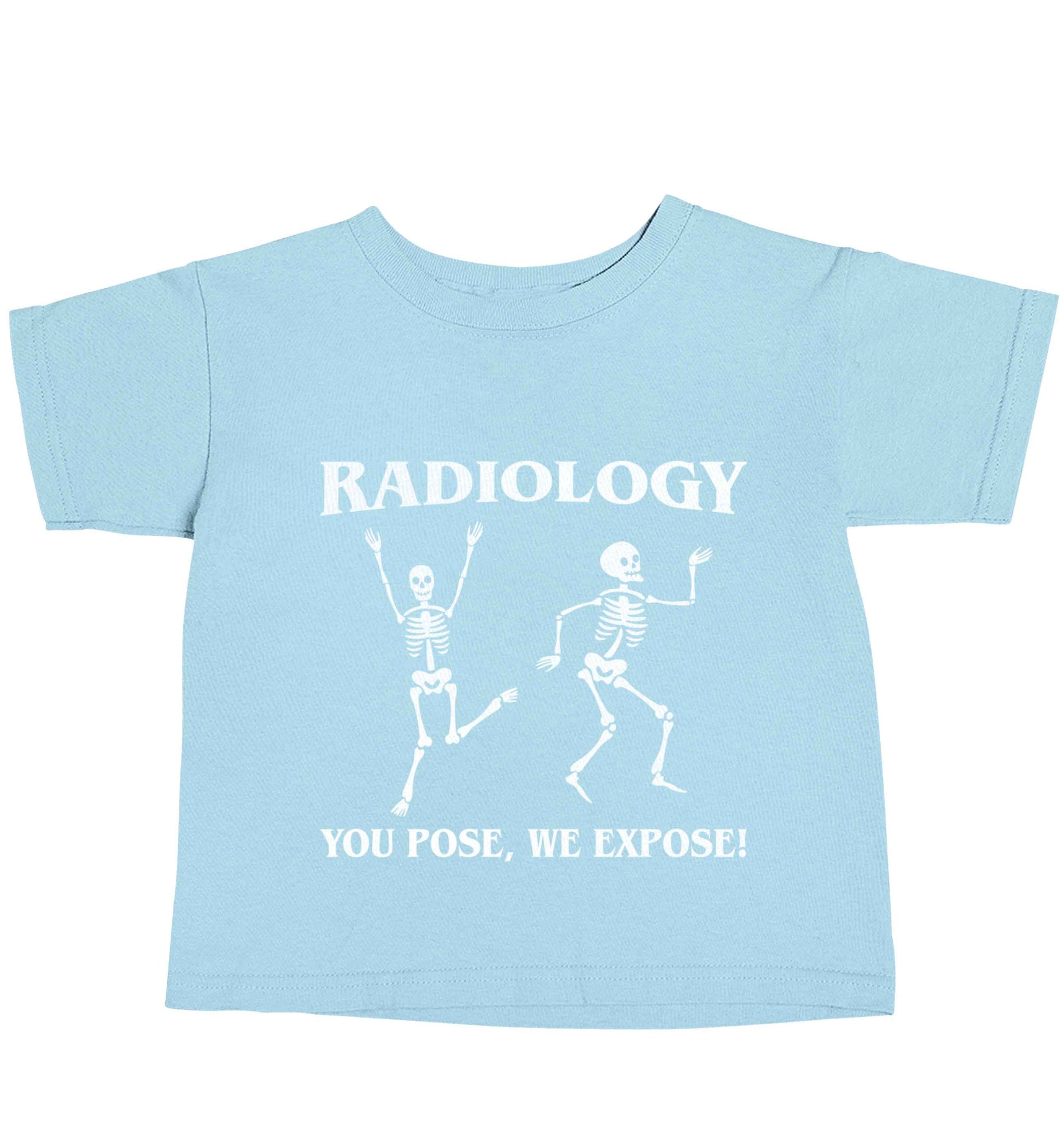 Radiology you pose we expose light blue baby toddler Tshirt 2 Years