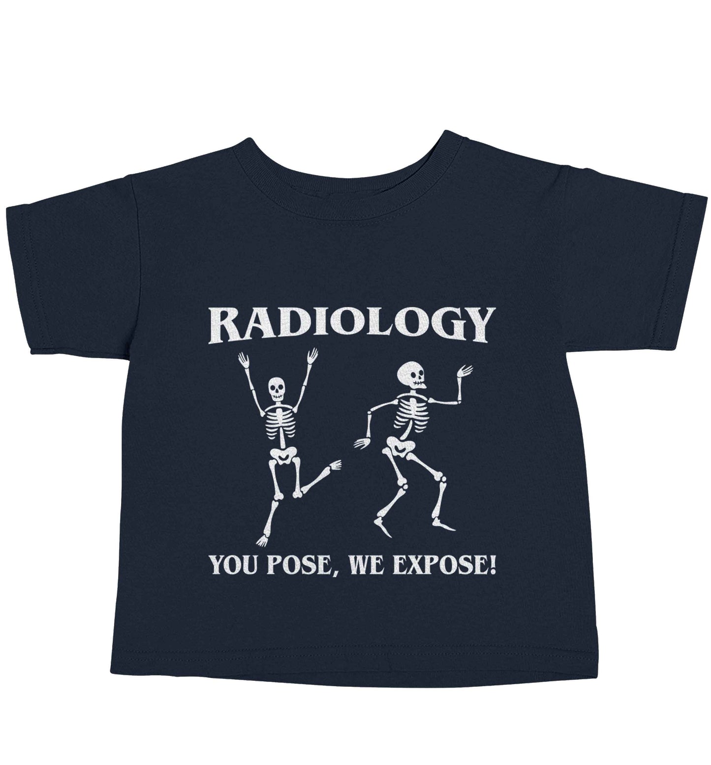 Radiology you pose we expose navy baby toddler Tshirt 2 Years