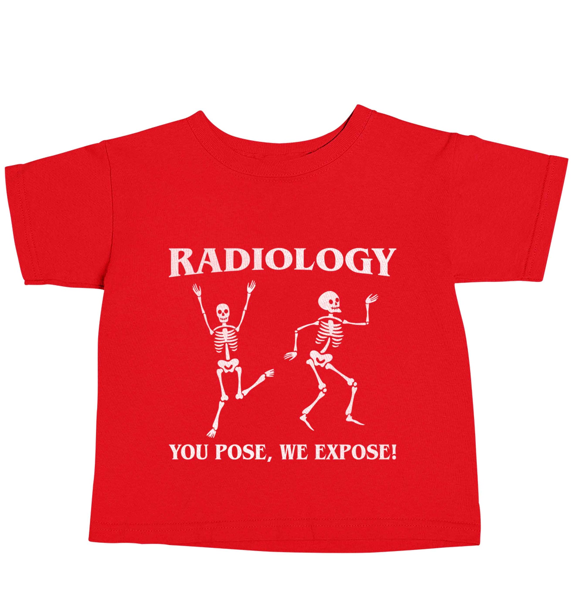 Radiology you pose we expose red baby toddler Tshirt 2 Years